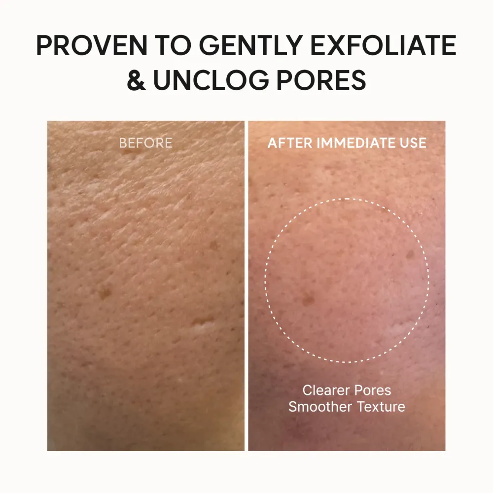 Arencia Fresh Green Rice Mochi Cleanser 120g – Καθαριστικό Προσώπου με Ρύζι & Πράσινο Τσάι - Arencia - glowfit.gr