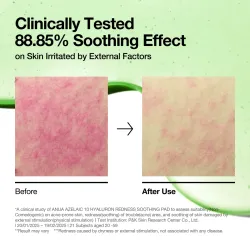 Anua Azelaic Acid 10 Hyaluron Redness Soothing Pads – Pads για Ερυθρότητα & Ακμή - Anua - glowfit.gr