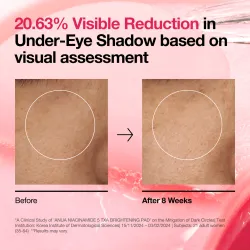 Anua Niacinamide 5% + TXA Brightening Pads 210ml– Pads Λάμψης για Δυσχρωμίες & Μαύρους Κύκλους - Anua - glowfit.gr