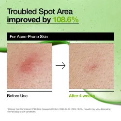 Azelaic Acid 10 Hyaluron Redness Soothing Serum 30ml Azelaic Acid 10 Hyaluron Redness Soothing Serum 30ml