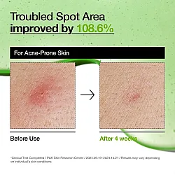 Anua Azelaic Acid 10 Hyaluron Redness Soothing Serum 30ml - κορεάτικος ορός για ερυθρότητα - glowfit.gr
