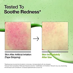 Anua Azelaic Acid 10 Hyaluron Redness Soothing Serum 30ml - κορεάτικος ορός για ερυθρότητα - glowfit.gr