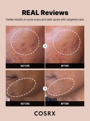 COSRX The Alpha Arbutin 2 Discoloration Care Serum – Δυσχρωμίες, Σημάδια & Ομοιόμορφος Τόνος 50ml