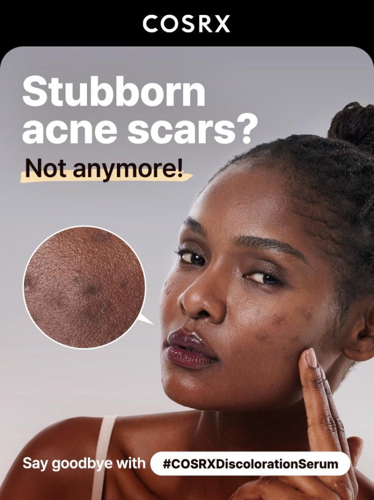 COSRX The Alpha Arbutin 2 Discoloration Care Serum – Δυσχρωμίες, Σημάδια & Ομοιόμορφος Τόνος 50ml