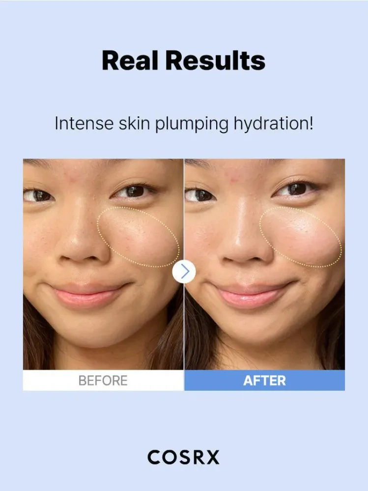 The Hyaluronic Acid 3 Serum 20ML The Hyaluronic Acid 3 Serum 20ML