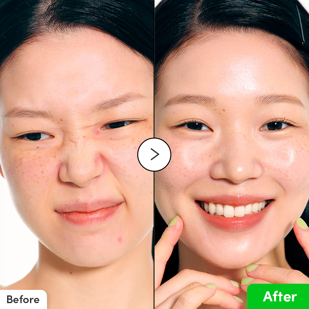 Eqqualberry Aloe PDRN Calming Serum 30ml – Καταπραϋντικός Ορός με Ceramides & CICA - EQQUALBERY - glowfit.gr