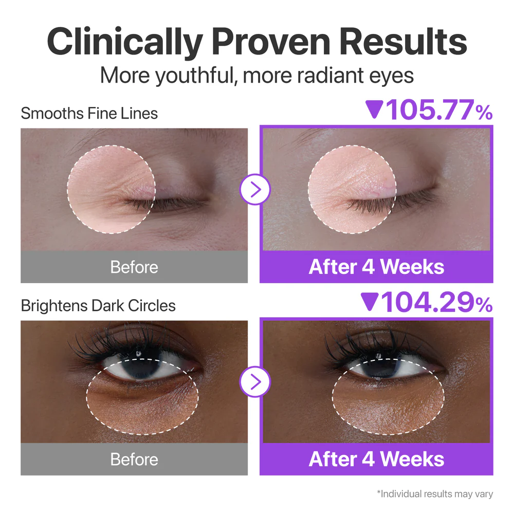 Numbuzin No.9 NAD Retinol Volumetox Eye Cream 10ml – Κρέμα Ματιών για Ρυτίδες & Σύσφιξη - Numbuzin - glowfit.gr