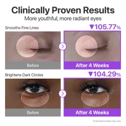 Numbuzin No.9 NAD Retinol Volumetox Eye Cream 10ml – Κρέμα Ματιών για Ρυτίδες & Σύσφιξη - Numbuzin - glowfit.gr