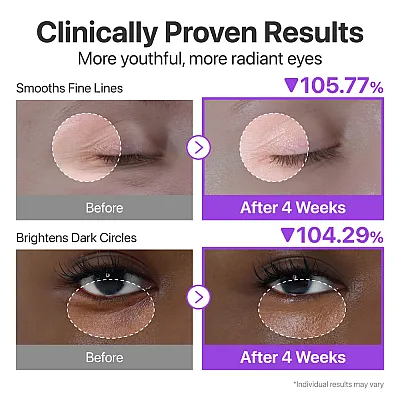 Numbuzin No.9 NAD Retinol Volumetox Eye Cream 10ml – Κρέμα Ματιών για Ρυτίδες & Σύσφιξη