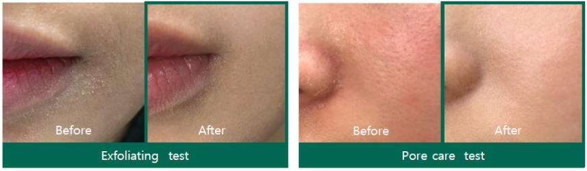 AHA-BHA-PHA 30 Days Miracle Toner 150ml