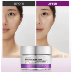 VT Reedle Shot Lifting Cream 50ml – Κρέμα Σύσφιξης με CICA REEDLE™ & Peptides -  - glowfit.gr