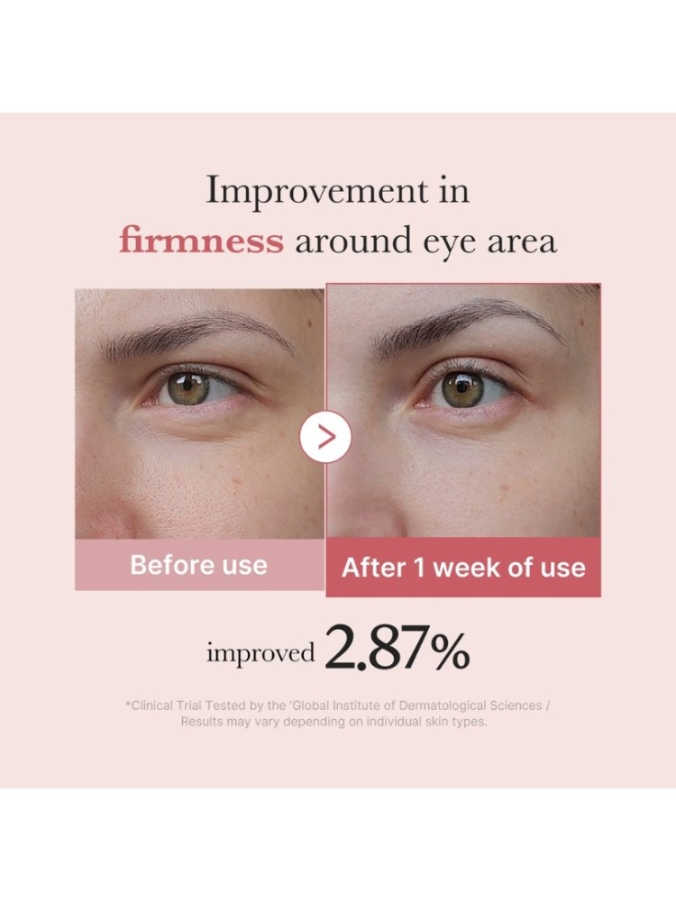 Medicube PDRN Pink Peptide Eye Cream 30ml – Κρέμα Ματιών με Ρετινόλη & Πεπτίδια -  - glowfit.gr