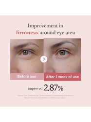Medicube PDRN Pink Peptide Eye Cream 30ml – Κρέμα Ματιών με Ρετινόλη & Πεπτίδια -  - glowfit.gr