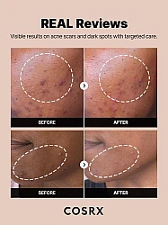 COSRX The Alpha Arbutin 2 Discoloration Care Serum – Δυσχρωμίες, Σημάδια & Ομοιόμορφος Τόνος 50ml - CosrX - glowfit.gr
