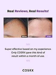 COSRX AHA/BHA Clarifying Treatment Toner 150ml - απολεπιστικό toner με AHA και BHA - glowfit.gr
