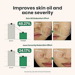 AXIS-Y Spot The Difference Blemish Treatment 15ml – Gel για Ακμή & Σπυράκια - Axis-Y - glowfit.gr
