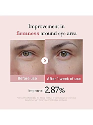 Medicube PDRN Pink Peptide Eye Cream 30ml – Κρέμα Ματιών με Ρετινόλη & Πεπτίδια -  - glowfit.gr