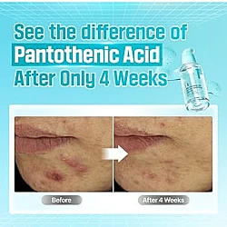 numbuzin No.1 Pantothenic B5 Active Soothing Serum 50ml - ορός με βιταμίνη Β5 - glowfit.gr