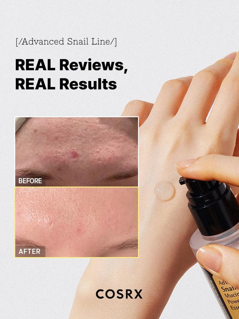 COSRX Advanced Snail 96 Mucin Power Essence 100ml - essence με 96% Snail Mucin - glowfit.gr