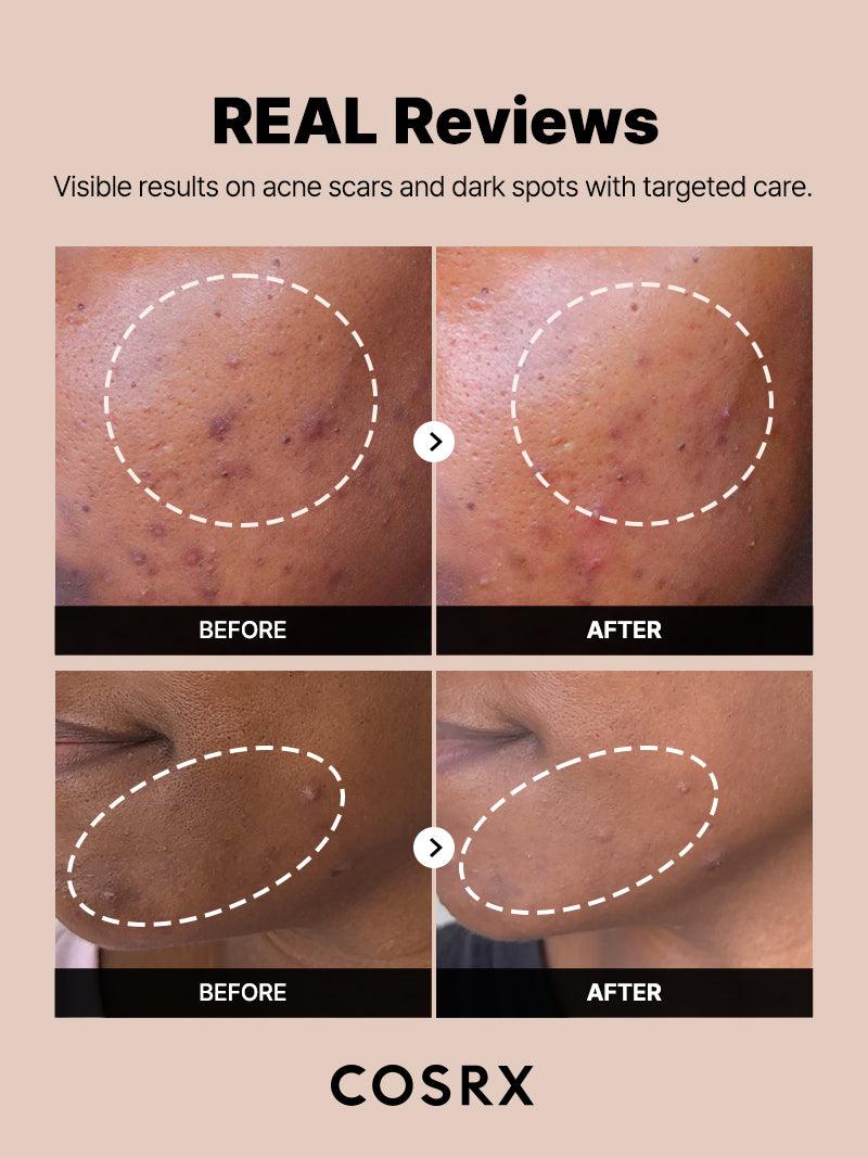 COSRX The Alpha Arbutin 2 Discoloration Care Serum – Δυσχρωμίες, Σημάδια & Ομοιόμορφος Τόνος 50ml - CosrX - glowfit.gr