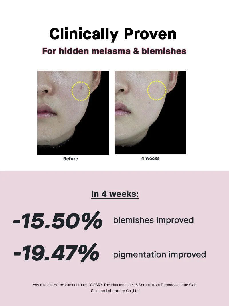 COSRX The Niacinamide 15 Serum 20g – Ορός υψηλής ισχύος με 15% νιασιναμίδη για ακμή, λιπαρότητα & σημάδια - CosrX - glowfit.gr