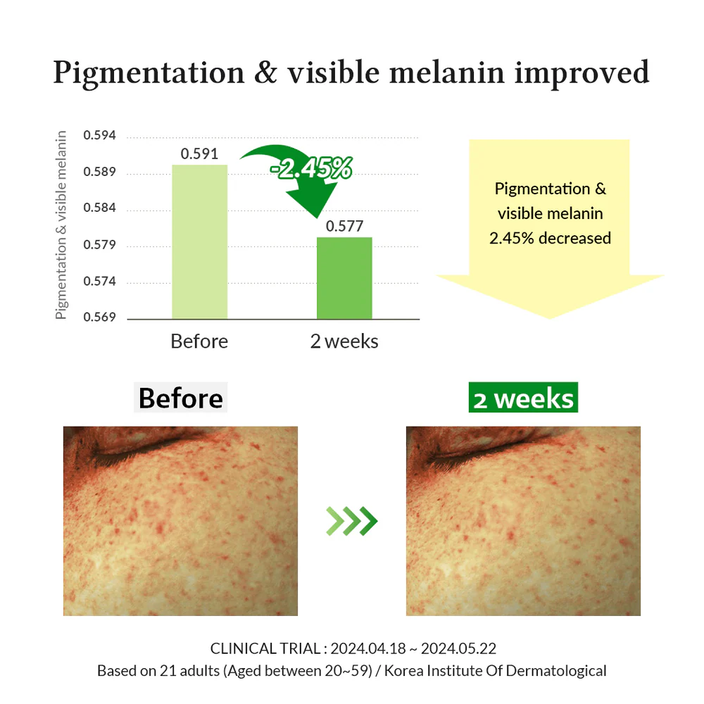 Gentle Vitamin C Serum 30ml - Dr. Althea - glowfit.gr