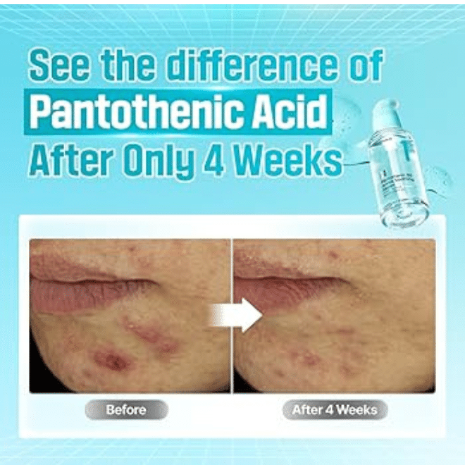numbuzin No.1 Pantothenic B5 Active Soothing Serum 50ml - ορός με βιταμίνη Β5 - glowfit.gr
