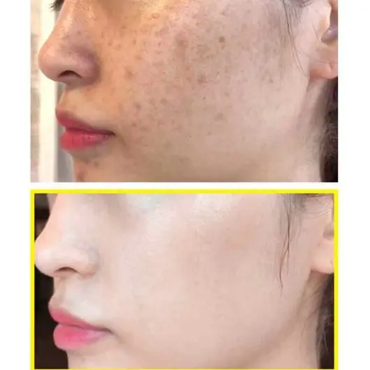 Yuja Niacin Blemish Care Serum Brightening Sheet Mask 25g - Some By Mi - glowfit.gr