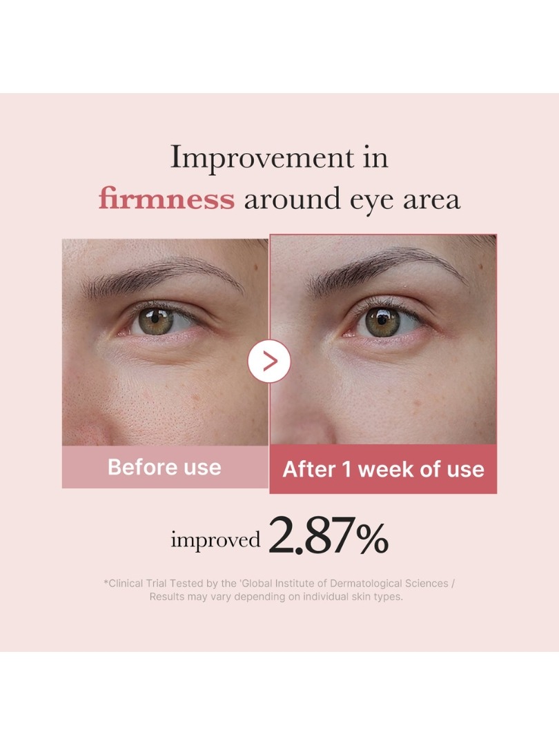 Medicube PDRN Pink Peptide Eye Cream 30ml – Κρέμα Ματιών με Ρετινόλη & Πεπτίδια -  - glowfit.gr
